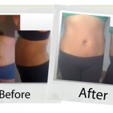 your-hcg-before-after_davelyn